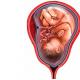 Leakage of amniotic fluid during pregnancy symptoms
